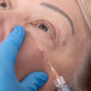 Micro cannula